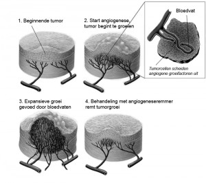 Fig1_Antiangiogenic therapy_Reduced res